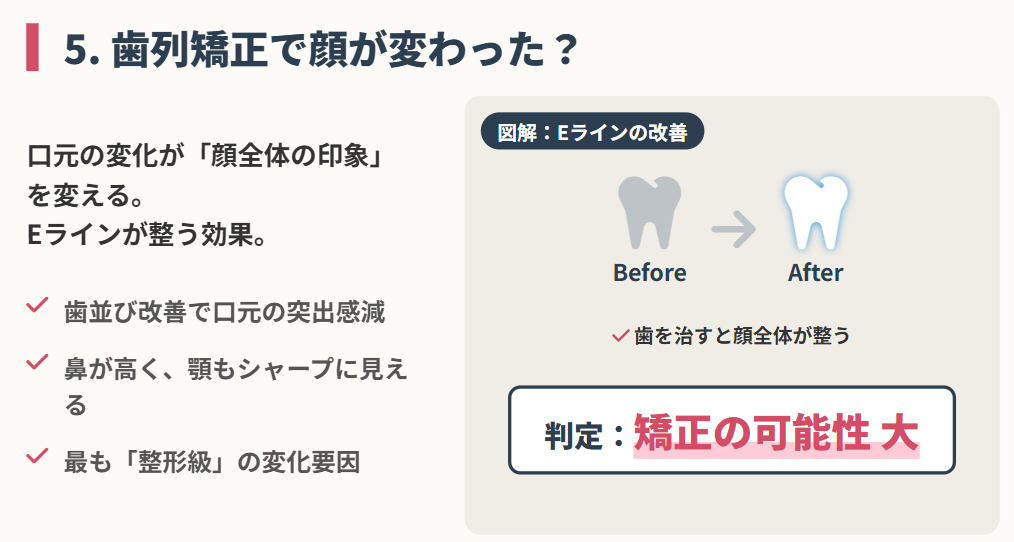 石川佳純　整形　歯列矯正で口元のバランスが整った可能性