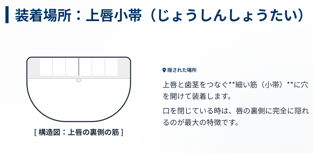 アリサリウ　上唇小帯のスマイリーピアスとは２