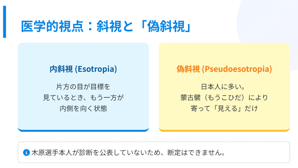 木原龍一 斜視の可能性や医学的な一般論を解説
