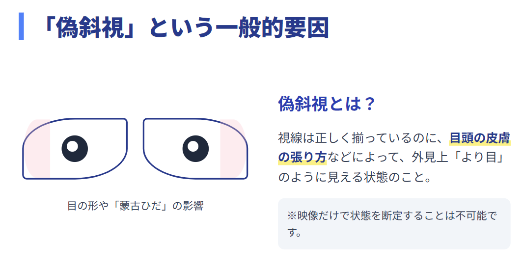 越水遥　黒目の位置や見え方の一般的な要因
