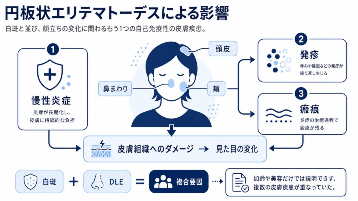 マイケルジャクソンはどうやって白くなったのか 円板状エリテマトーデスによる影響