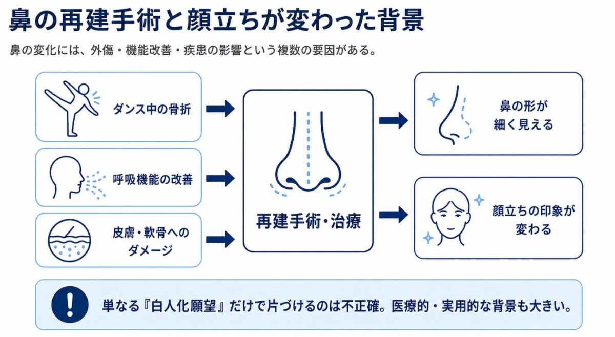 尋常性白斑という皮膚の病気が原因 鼻の再建手術と顔立ちが変わった背景