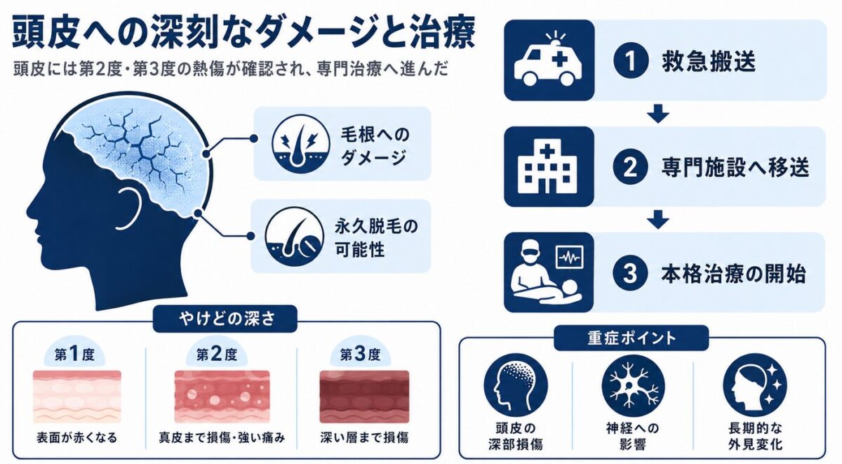 マイケルジャクソンのやけど　頭皮への深刻なダメージと治療