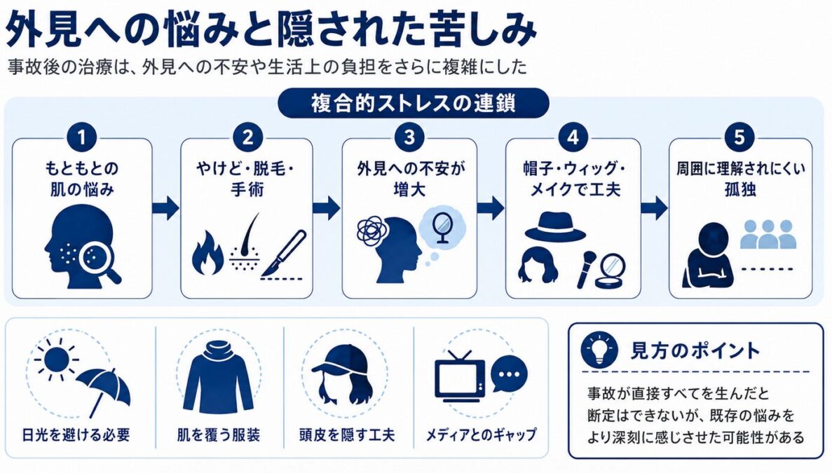 マイケルジャクソンのやけどの影響　外見への悩みと隠された苦しみ